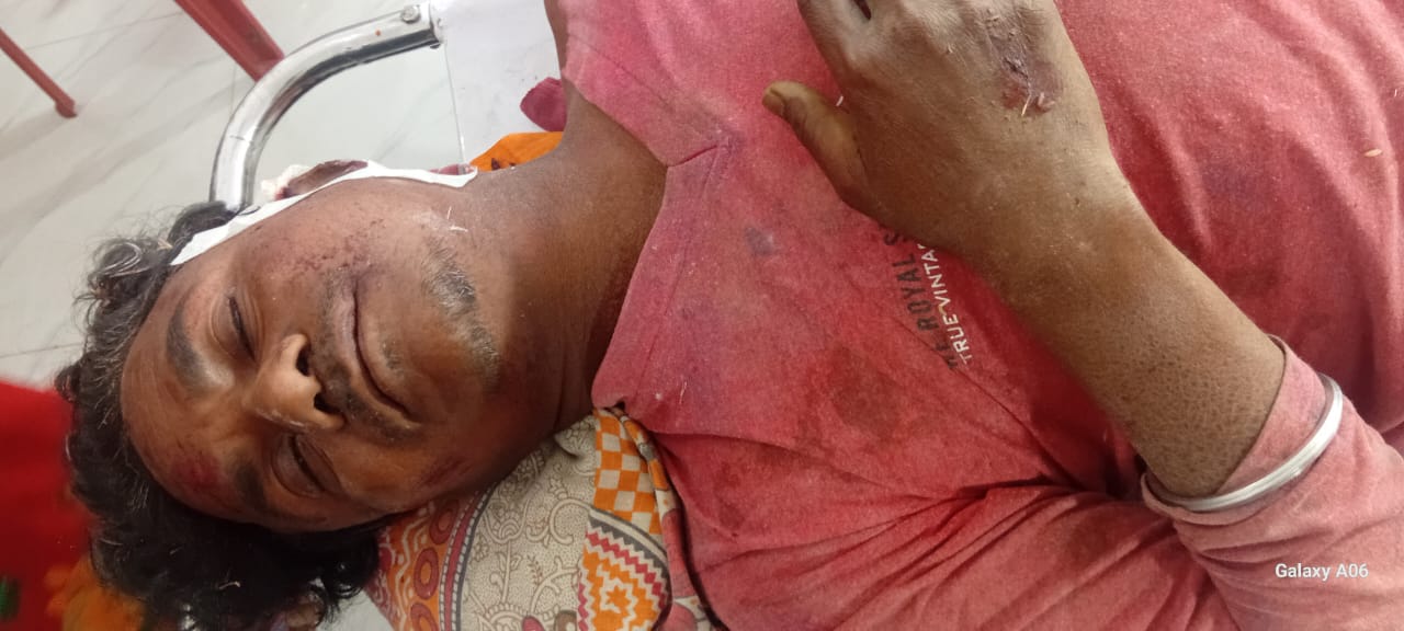 तालझारी–महाराजपुर मुख्य मार्ग पर ई-रिक्शा दुर्घटनाग्रस्त, दो लोग घायल