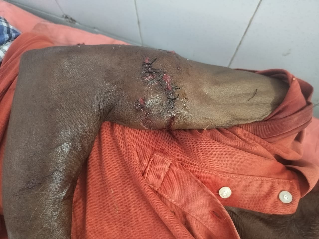 कुत्तों के आतंक से ग्रामीणों में दहशत, वन विभाग पर लापरवाही का आरोप