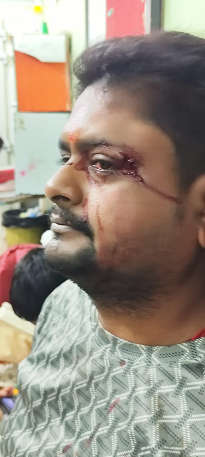 पत्रकार देव सोनी पर जानलेवा हमले का आरोप, दवा दुकान में घुसकर मारपीट